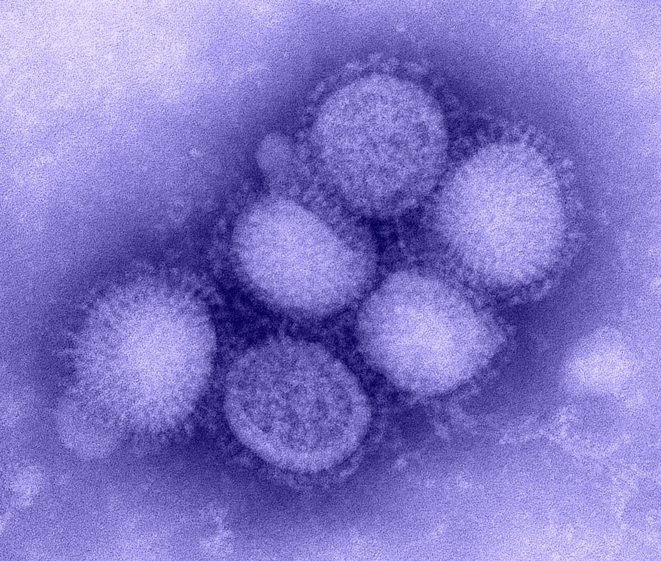Спин грипп. Вирус свиного гриппа (h1n1). H2n2 вирус. Вирус гриппа под микроскопом h1n1. Возбудитель гриппа Orthomyxoviridae.