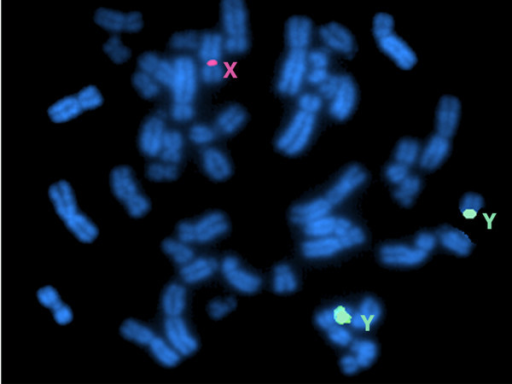 A confocal microscope image showing an XYY chromosome karyotype