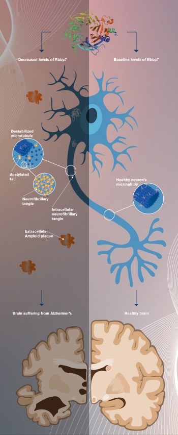 Untangling The Brain: New Research Offers Hope For Fighting Alzheimer’s ...