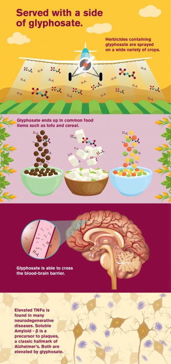 Infographic on neuroinflammation