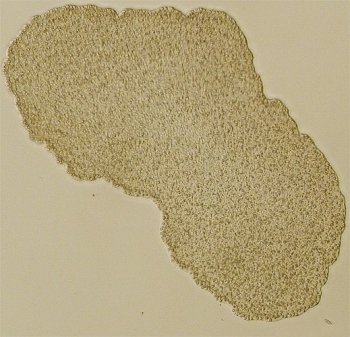 Close-up image of Trichoplax adhaerens, one of the three species belonging to the the phylum Placozoa.