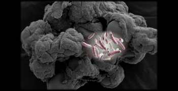 Image of salmonella bacteria set against an illustration of a 3D model of human tissue.