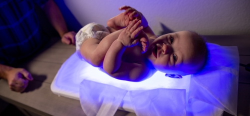 neolight baby light treatment