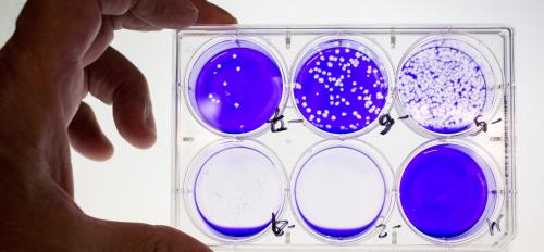Stained culture dishes holding viruses and cells in a lab.