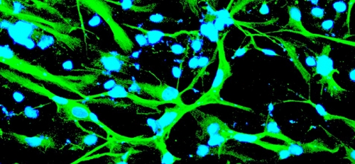 Neurons made from stem cells