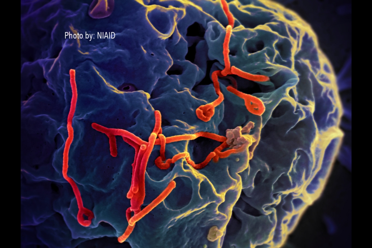 Ebola virus budding from the surface of an infected cell.
