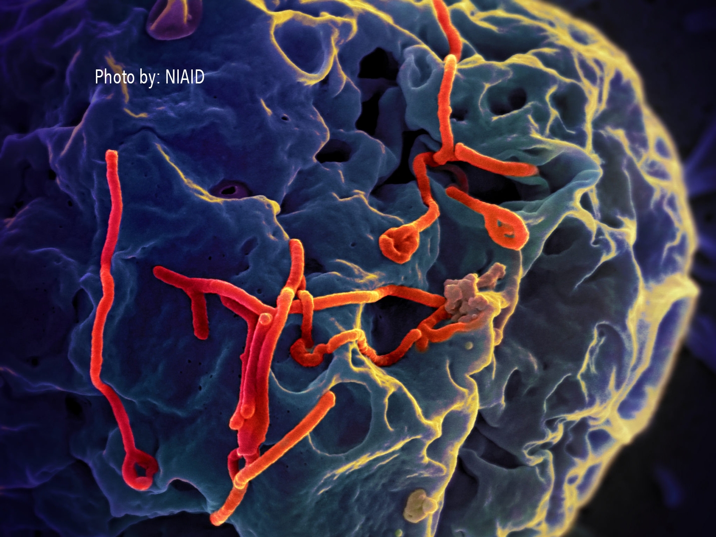ASU engineer's lab partnering with US Army to improve Ebola detection