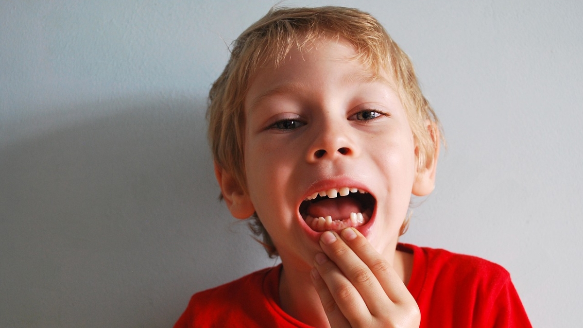 A child showing his missing teeth.