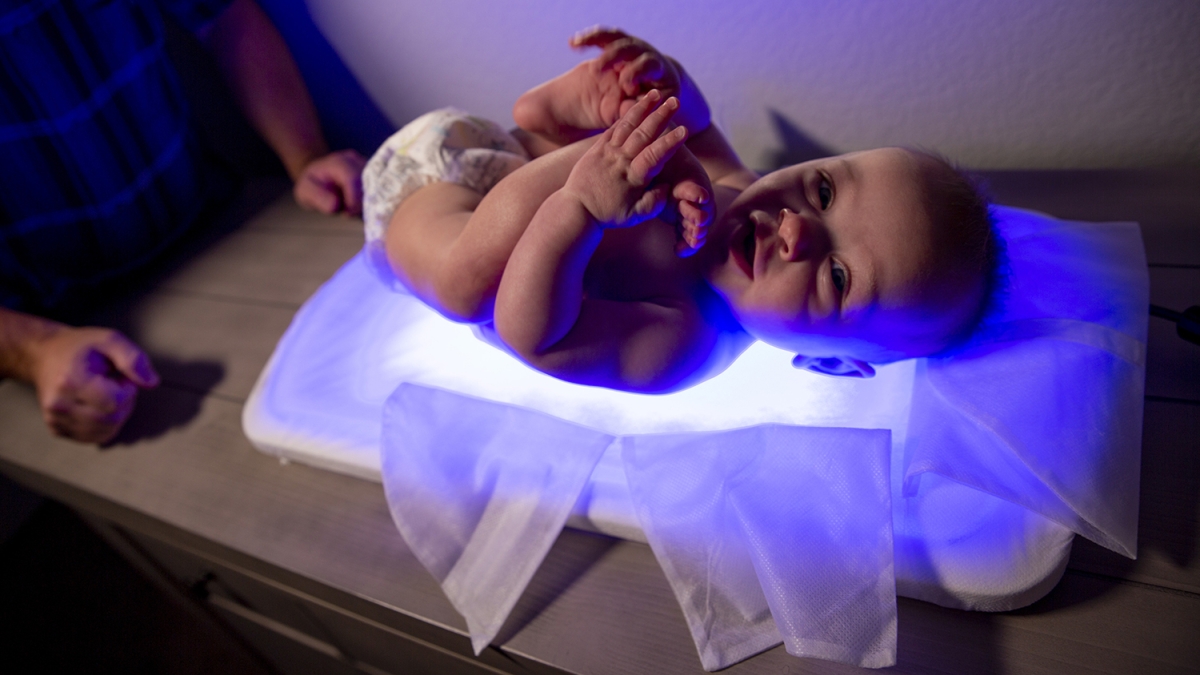 neolight baby light treatment
