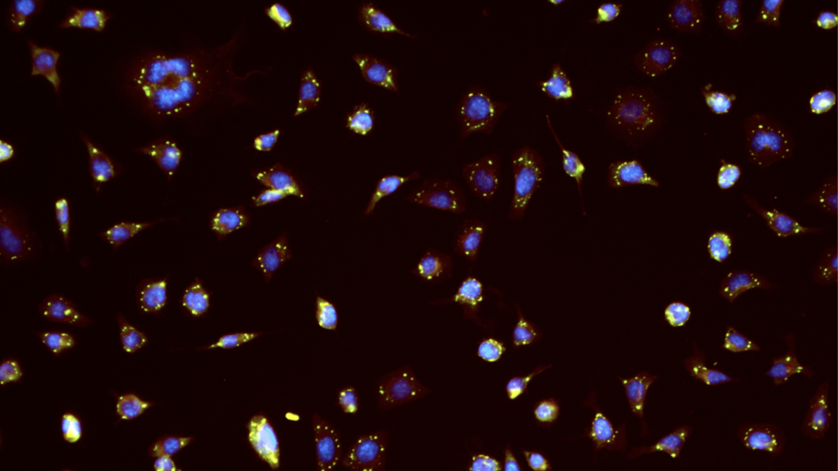 Image showing cells and how ZBP1 localizes to stress granules during arsenite-induced necroptosis.