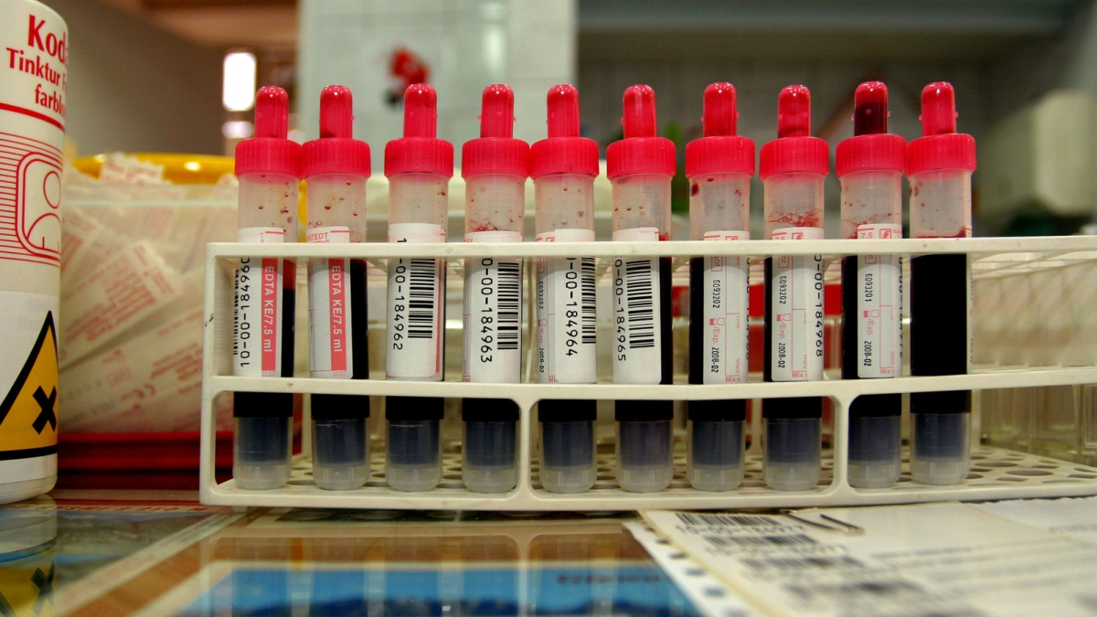 Blood in testing tubes.