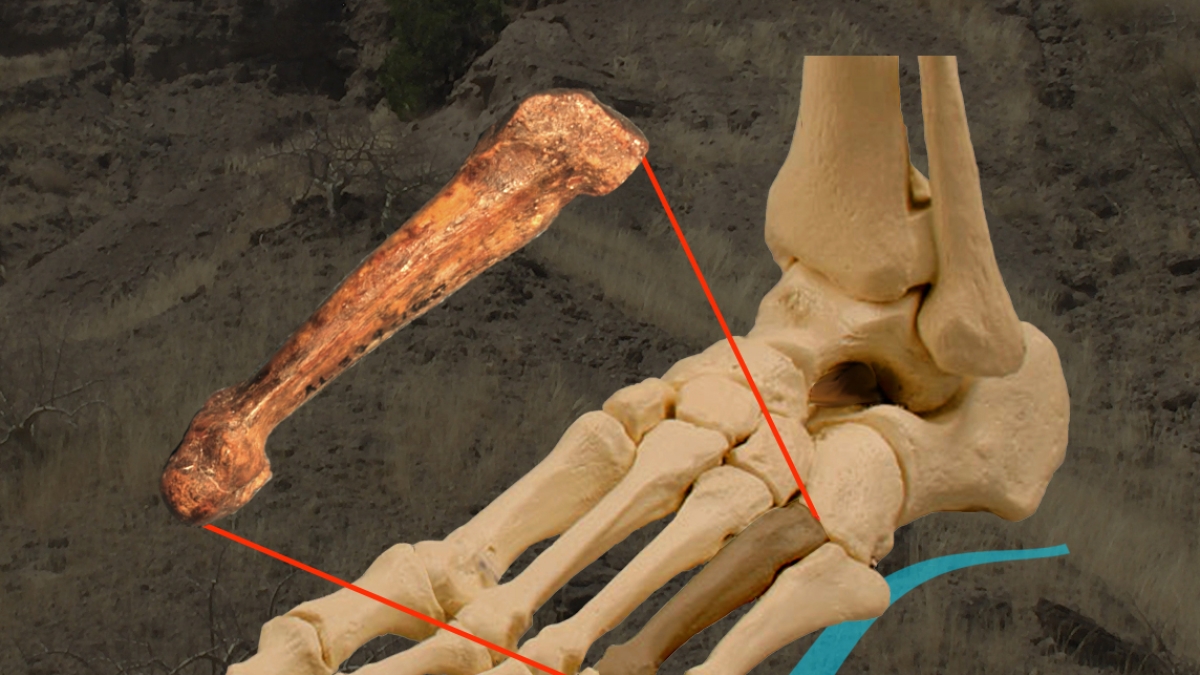 foot image with bone