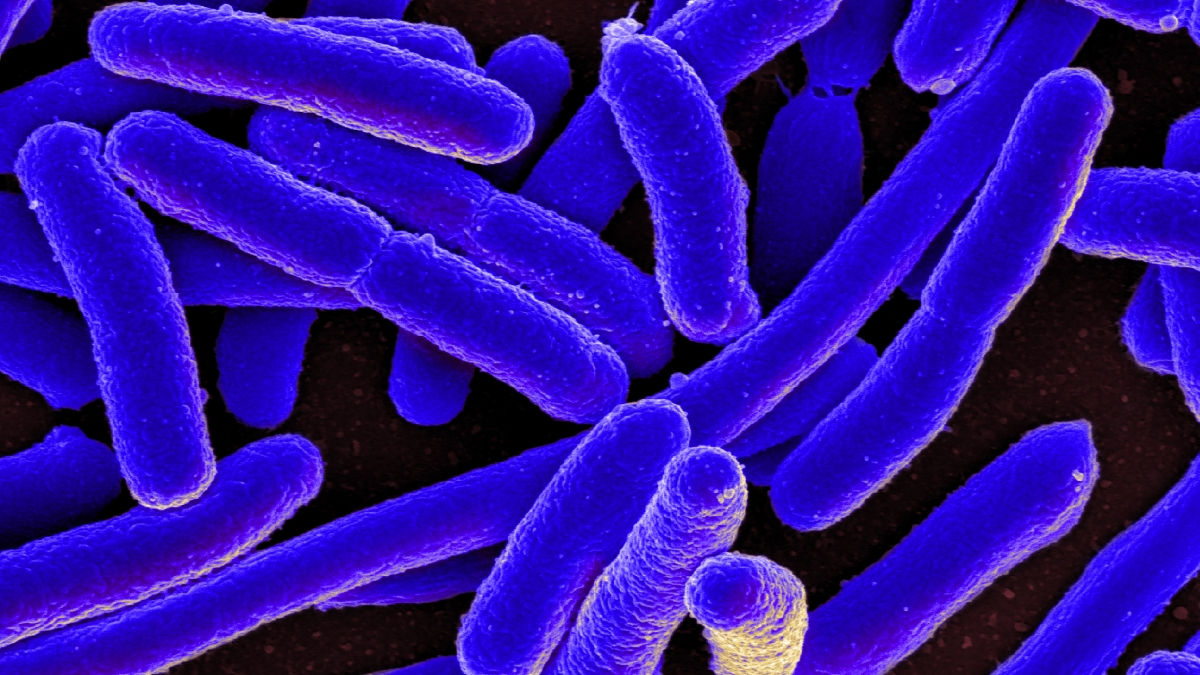 A closeup of E. coli
