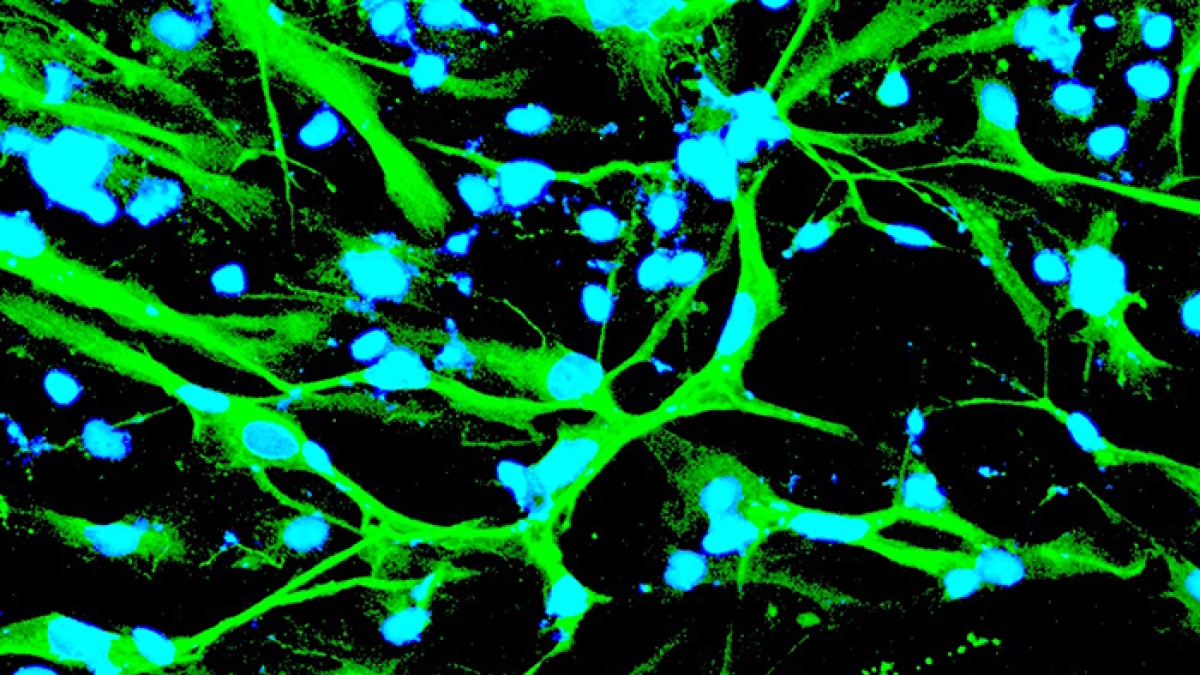 Neurons made from stem cells