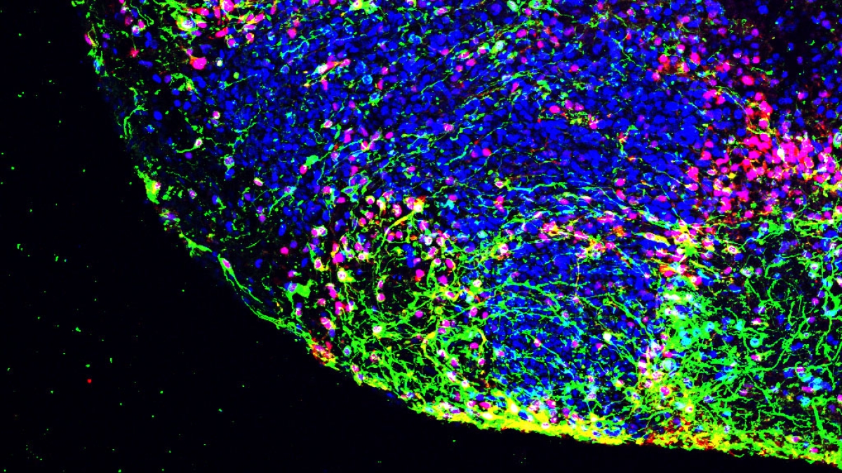 Close-up image of proteins present in brain tissue.