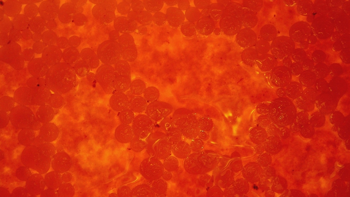 A closeup of blood cells.