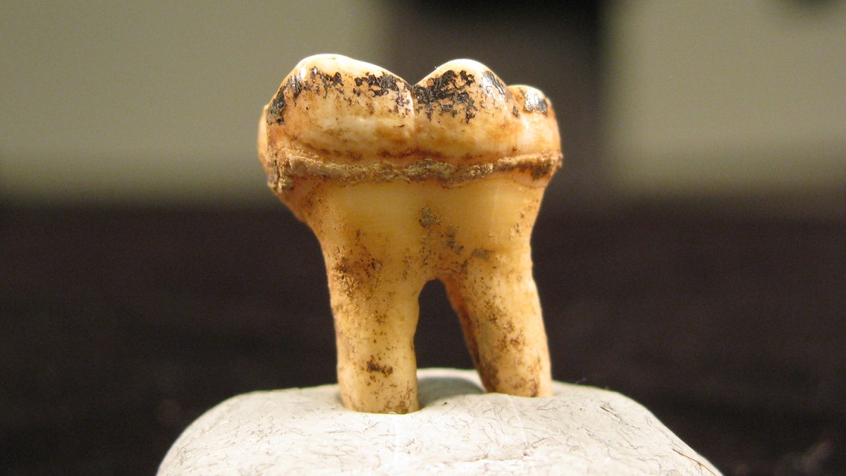 chimpanzee tooth with dental plaque