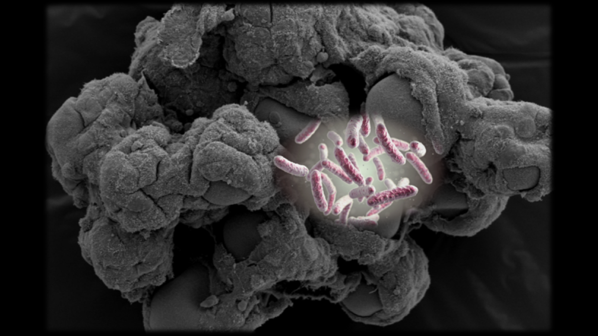 Image of salmonella bacteria set against an illustration of a 3D model of human tissue.