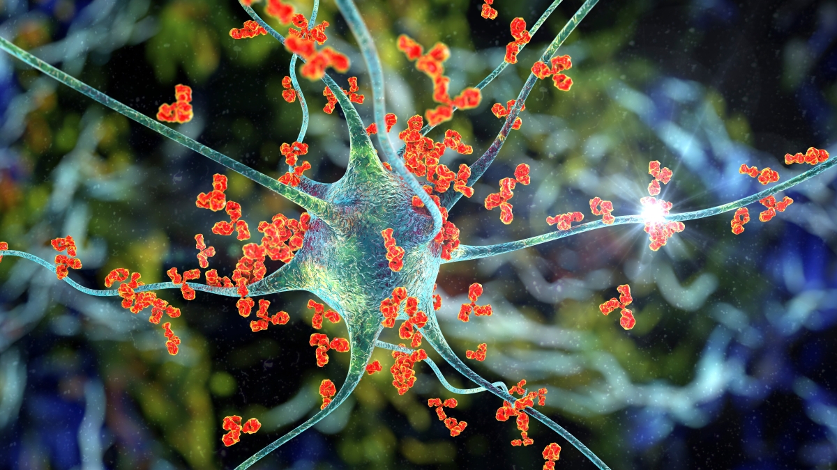 Graphic illustration of antibodies attacking a neuron.