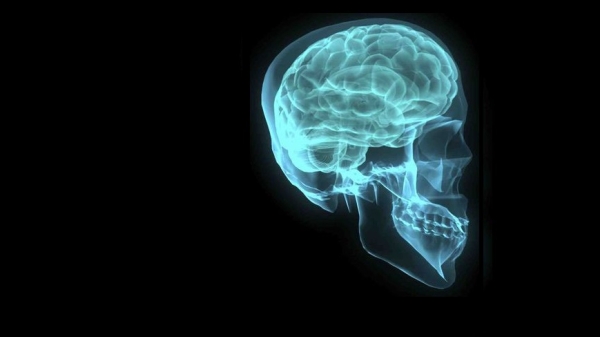 A human brain and skull are shown in an X-ray