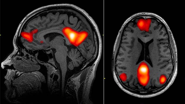 images of brain scans