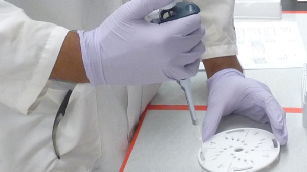 person&#039;s hands holding a dropper in a lab