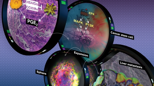 colon cancer graphic that shows how it is spread