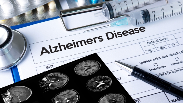 Stock photo of Alzheimer's chart with brain scans and medication