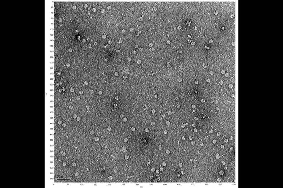 A negative stain electron microscopy image of a membrane pore.